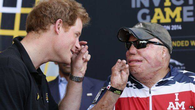 Prince Harry at Invictus Games Orlando with burn wound soldier 